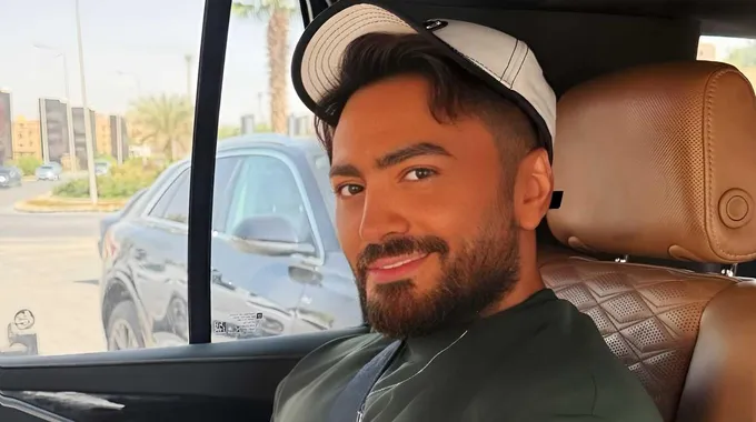تامر حسني يكشف عن إصابة بسيطة في ذراعه