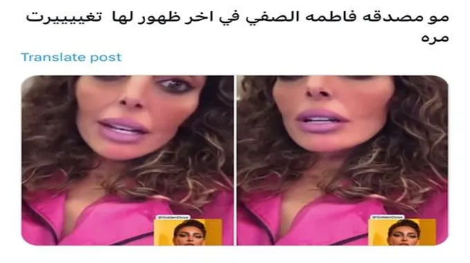 فاطمة الصفي تصدم الجمهور بعد تغير ملامحها